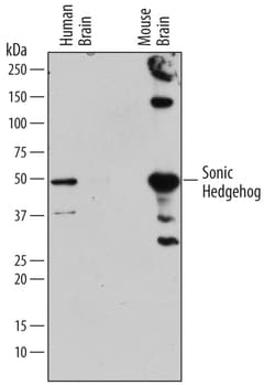 Human/Mouse Sonic Hedgehog N-Terminus Antibody, R D Systems 500ug; Unlabeled:Antibodies,