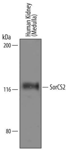 Human SorCS2 Antibody, R D Systems 100&mu;g; Unlabeled:Antibodies, Polyclonal