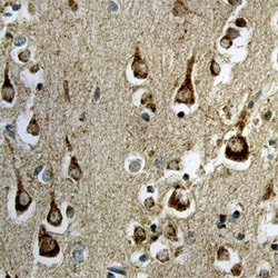 Human Sortilin Antibody, R D Systems 25&mu;g; Unlabeled:Antibodies, Polyclonal