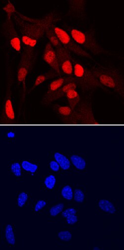 Human/Mouse/Rat SOX1 Antibody, R D Systems 25&mu;g; Unlabeled:Antibodies,
