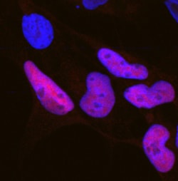 Human SOX10 Antibody, R D Systems 100&mu;g; Unlabeled:Antibodies, Polyclonal