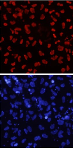 Human SOX17 Antibody, R D Systems 100&mu;g; Unlabeled:Antibodies, Polyclonal
