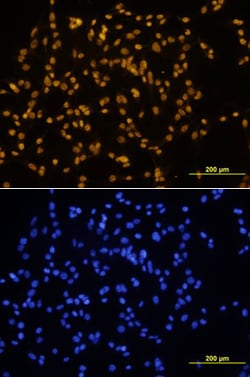 Human SOX17 Antibody, R D Systems 25&mu;g; Unlabeled:Antibodies, Monoclonal