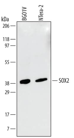 Human/Mouse/Rat SOX2 Antibody, R D Systems 100&mu;g; Unlabeled:Antibodies,