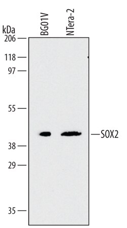 Human/Mouse/Rat SOX2 Antibody, R D Systems 25&mu;g; Unlabeled:Antibodies,