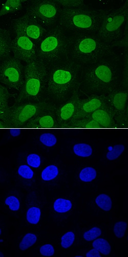 Human SOX3 Antibody, R D Systems 100&mu;g; Unlabeled:Antibodies, Polyclonal