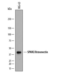 Human SPARC Antibody, R D Systems 25&mu;g; Unlabeled:Antibodies, Polyclonal