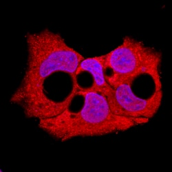 Human Sphingosine Kinase 1/SPHK1 Antibody, R D Systems 100&mu;g; Unlabeled:Antibodies,