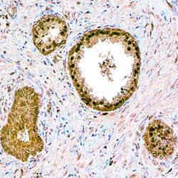 Human Sphingosine Kinase 1/SPHK1 Antibody, R D Systems 100&mu;g; Unlabeled:Antibodies,