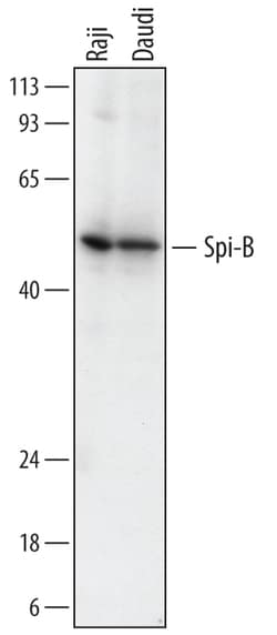 Human Spi-B Antibody, R D Systems 25&mu;g; Unlabeled:Antibodies, Monoclonal