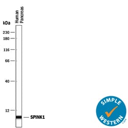 Human SPINK1 Antibody, R D Systems 25&mu;g; Unlabeled:Antibodies, Polyclonal