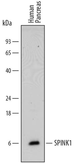 Human SPINK1 Antibody, R D Systems 25&mu;g; Unlabeled:Antibodies, Polyclonal