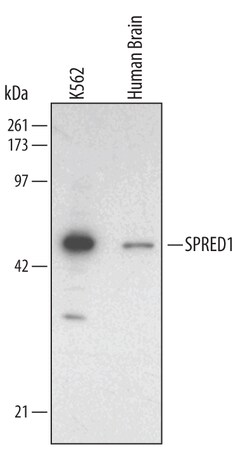 Human SPRED1 Antibody, R D Systems 100&mu;g; Unlabeled:Antibodies, Polyclonal