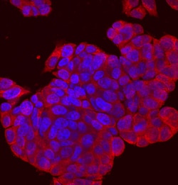Human SPRED2 Antibody, R D Systems 25&mu;g; Unlabeled:Antibodies, Polyclonal