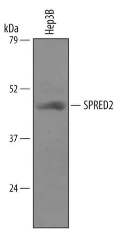 Human SPRED2 Antibody, R D Systems 25&mu;g; Unlabeled:Antibodies, Polyclonal