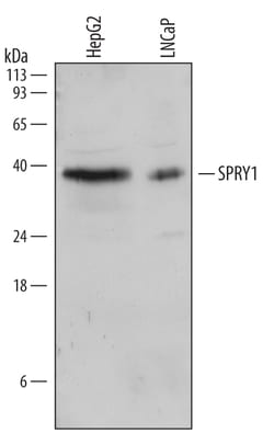 Human SPRY1 Antibody, R D Systems 25&mu;g; Unlabeled:Antibodies, Polyclonal