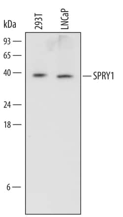 Human SPRY1 Antibody, R D Systems 100 &mu;g | Buy Online | R&D Systems | Fisher Scientific