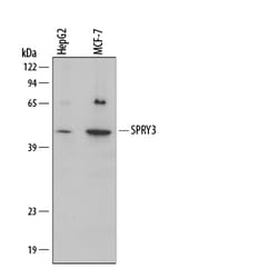 Human SPRY3 Antibody, R D Systems 25&mu;g; Unlabeled:Antibodies, Polyclonal