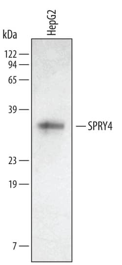 Human SPRY4 Antibody, R D Systems 25&mu;g; Unlabeled:Antibodies, Polyclonal