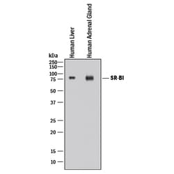 Human SR-BI Antibody, R D Systems:Antibodies:Primary Antibodies