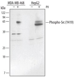 Human Phospho-Src (Y419) Antibody, R D Systems 100&mu;g; Unlabeled:Antibodies,