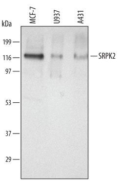 Human SRPK2 Antibody, R D Systems 25&mu;g; Unlabeled:Antibodies, Polyclonal