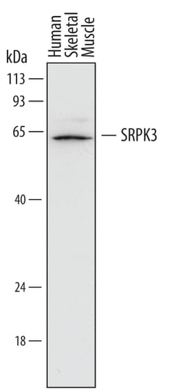 Human SRPK3 Antibody, R D Systems 100ug; Unlabeled:Antibodies, Monoclonal
