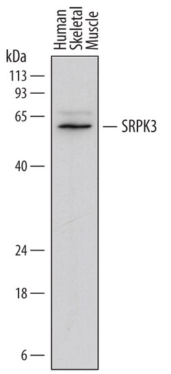 Human SRPK3 Antibody, R D Systems 25&mu;g; Unlabeled:Antibodies, Monoclonal