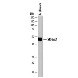 Human ST3 beta-Gal alpha-2,3-Sialyltransferase 1/ST3GAL1 Antibody, R D