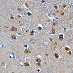 Human ST6 Gal Sialyltransferase 2/ST6GAL2 Antibody, R D Systems 100&mu;g;