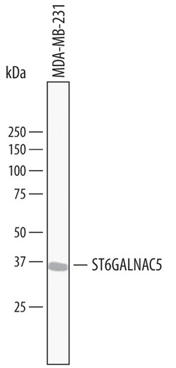 Human ST6 GalNAc alpha-2,6-sialyltransferase V/ST6GALNA Antibody, R D Systems:Antibodies:Primary