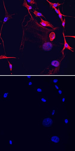 Human ST6 GalNAc alpha-2,6-sialyltransferase V/ST6GALNAC5 Antibody, R D