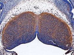 Human ST8 alpha-2,8-Sialyltransferase 8B/ ST8SIA2 Antibody, R D Systems