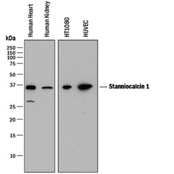 Human Stanniocalcin 1/STC-1 Antibody, R D Systems 100ug; Unlabeled:Antibodies,