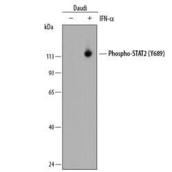 Human Phospho-STAT2 (Y689) Antibody, R D Systems 25 ug; Unconjugated:Antibodies,