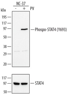 Human Phospho-STAT4 (Y693) Antibody, R D Systems 100&mu;g; Unlabeled:Antibodies,