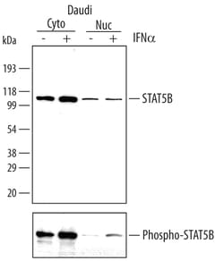 Human STAT5b Antibody, R D Systems 100ug; Unlabeled:Antibodies, Monoclonal