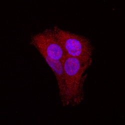 Human/Mouse/Rat STAT5b Antibody, R D Systems 100 ug; Unconjugated:Antibodies,