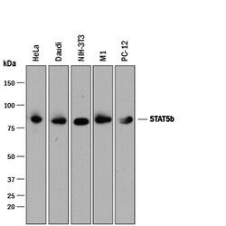 Human/Mouse/Rat STAT5b Antibody, R D Systems 100 ug; Unconjugated:Antibodies,