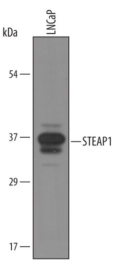 Human STEAP1 Antibody, R D Systems 25&mu;g; Unlabeled:Antibodies, Polyclonal