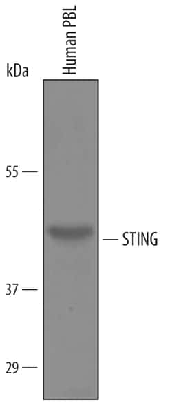 Human STING/TMEM173 Antibody, R D Systems 100&mu;g; Unlabeled:Antibodies,