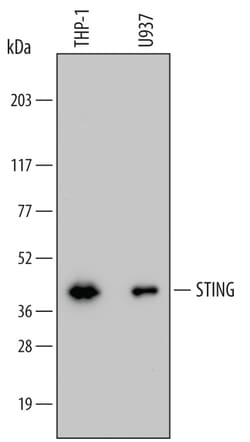 Human STING/TMEM173 Antibody, R D Systems 100ug; Unlabeled:Antibodies,