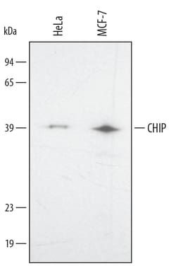Human CHIP/STUB1 Antibody, R D Systems 25&mu;g; Unlabeled:Antibodies, Polyclonal