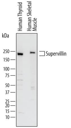 Human Supervillin Antibody, R D Systems 100&mu;g; Unlabeled:Antibodies,