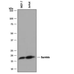 Human Survivin Affinity Purified Polyclonal Ab, R D Systems 25&mu;g; Unlabeled:Antibodies,