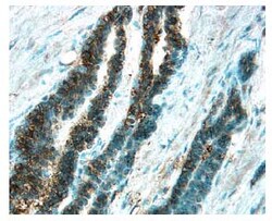 Human Survivin Antibody, R D Systems 25&mu;g; Unlabeled:Antibodies, Polyclonal