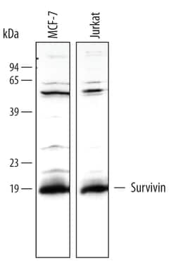 Human Survivin Antibody, R D Systems 25&mu;g; Unlabeled:Antibodies, Polyclonal