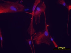 SUZ12 Mouse anti-Human, Clone: 448909, R D Systems 25&mu;g; Unlabeled,