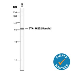 Human SYK (SH2D2 Domain) Antibody, R D Systems 100ug; Unlabeled:Antibodies,