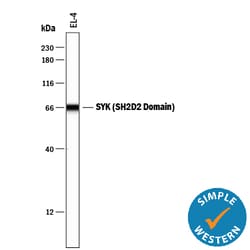 Human SYK (SH2D2 Domain) Antibody, R D Systems 100ug; Unlabeled:Antibodies,